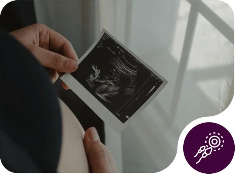 Hands holding a pregnancy ultrasound image