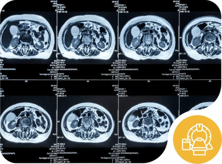 Series of magnetic resonance (MRI) images